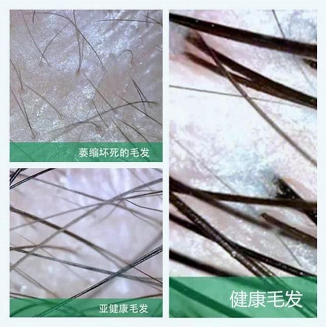 带你走进植发医院,深入解析毛囊检测全过程