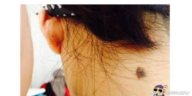 "此处"之痣,千万不要去掉,无论男女,都有好运气,富贵不愁!