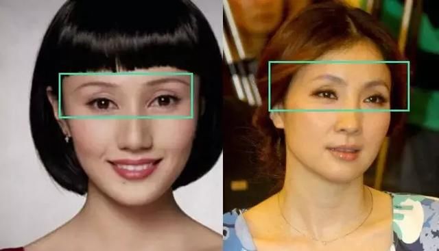热巴眼皮松弛快,郑爽大小眼,一半的明星眼睛都正遭遇这3个问题
