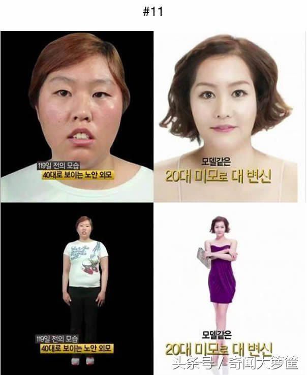 18个韩国人整形的例子,证实现在不需要投胎也能变天菜