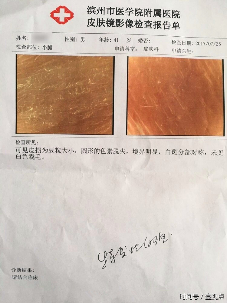 普通白斑变"白癜风"?滨州京城皮肤病医院"专家"真能忽悠!