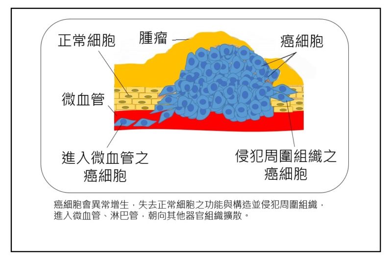 癌细胞的特点_癌细胞的概念