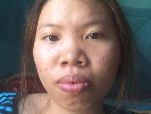 太丑没人娶 整容后从丑女逆袭成女神,成功嫁给了富二代!