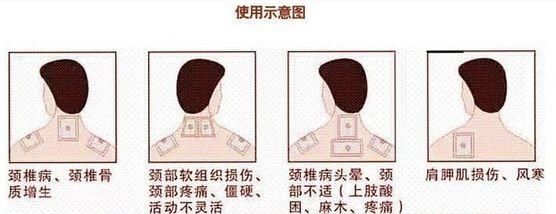 除此上述三点之外,经络膏按传统医学内外治理论和原理传导生姜疗法,以鸡胸v经络仪生产厂家图片