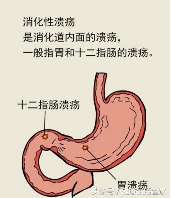 受凉时,胃部肌肉,血管会收缩,发生胃痉挛,像抽筋一样.