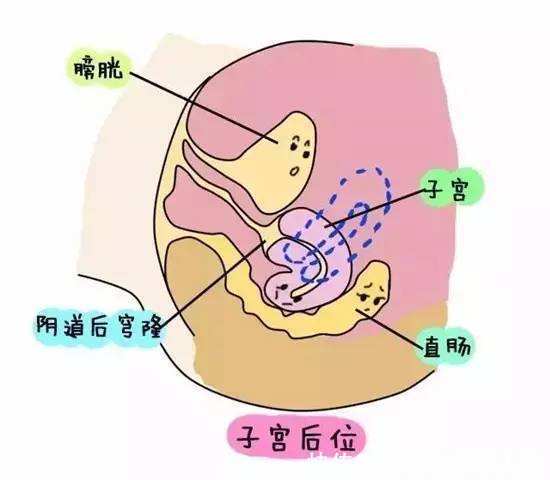 当膀胱空虚时,站立位的子宫位置一般呈轻度的前倾前屈位,也就是