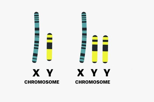 xyy型染色体的人是什么样的?