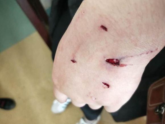 梦见被狗咬,周公解梦为你分析处境 梦见被狗咬,周公解梦为你分析处境