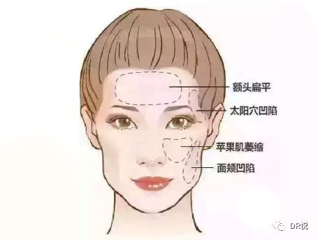 想变成笑起来很甜的女友脸,需要分几步|案例