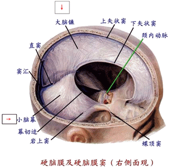 2,各种颅内肿瘤特别是位于一侧大脑半球的肿瘤和颅后窝肿瘤; 3,颅内