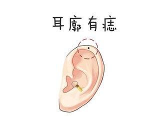 右女人有痣的事业表情包算我求了你们有旺夫运,在v女人耳朵上为图片