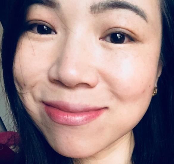 红润白皙的脸蛋是女人一个理想皮肤状态,睡前涂抹它8天斑点消失