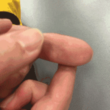 看看大拇指,就知道你肺部是否健康,养肺只需