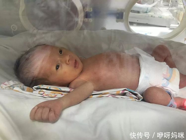 产妇孕7个月不幸早产,看到孩子那一刻,孕妈伤心痛哭!