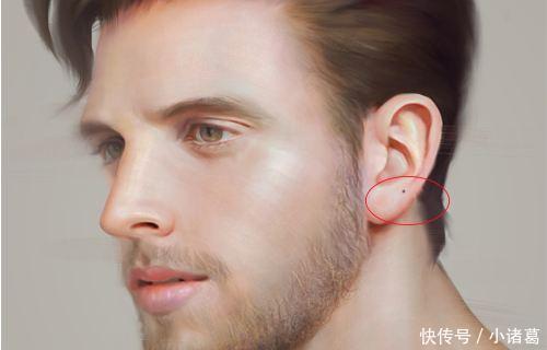 这三处有痣,不要取,以后荣华富贵享一生,特别女生幸福