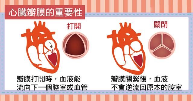 图解看台湾医生怎么说:心脏瓣膜病的病因,症状和治疗!
