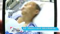 天降砖块儿人受重伤 高额治疗费谁来承担
