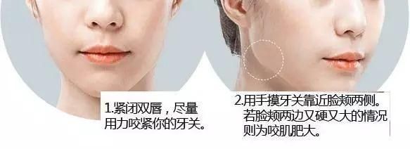 咬肌肥大变松鼠脸?有没有想过,咬肌瘦下来的