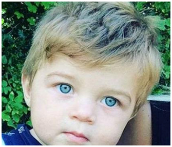 为什么偏偏我的头发那么少? --注意!这些不良习