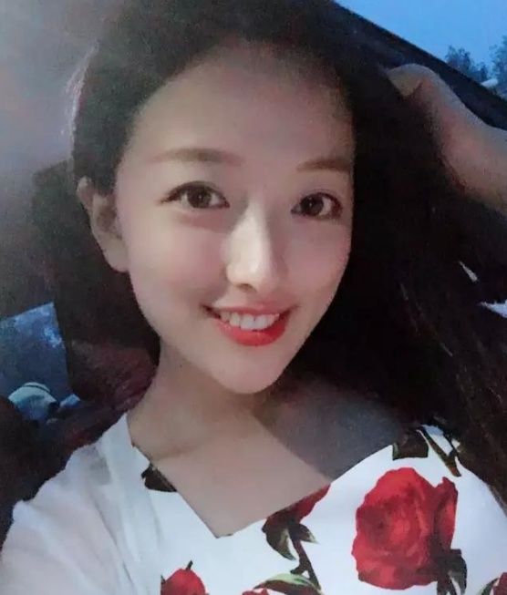 牙套一年半对比,箍牙邂逅老司机,恋爱到结婚,a