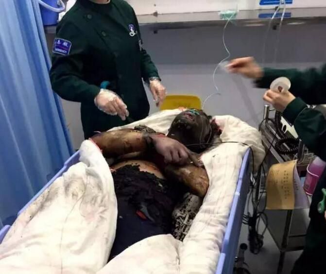 小伙在家自告奋勇下厨 几分钟后被烧成火人不治身亡