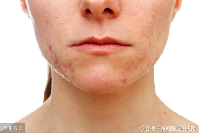 就会导致毒素超标,那么就很容易引起皮肤瘙痒等症状发生