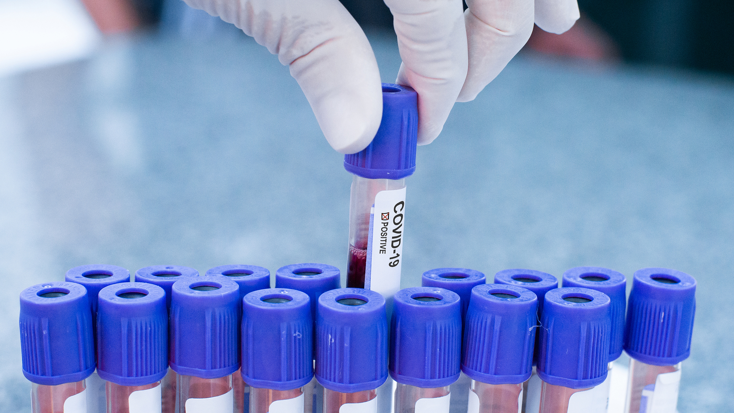 上海24日新增本地新冠肺炎确诊病例2例 境外输入确诊病例4例