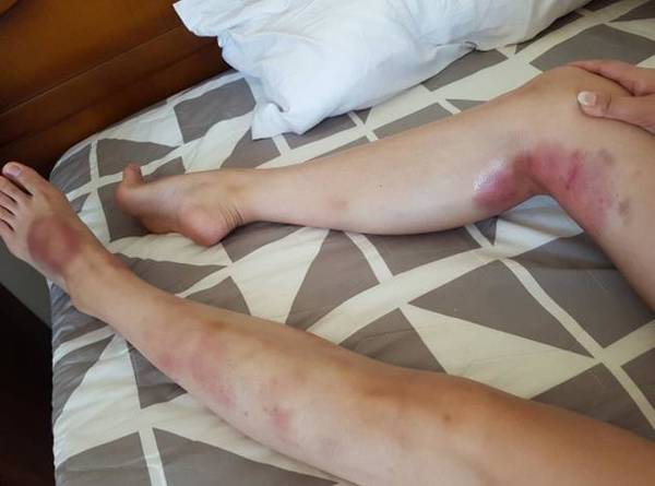 近年来单飞发展,积极参与综艺节目演出,展现精湛的舞蹈与歌唱实力