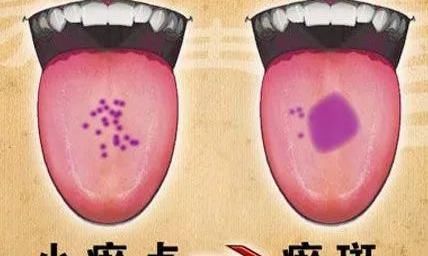 医生总看舌头都在看什么?九种体质+珍贵的舌