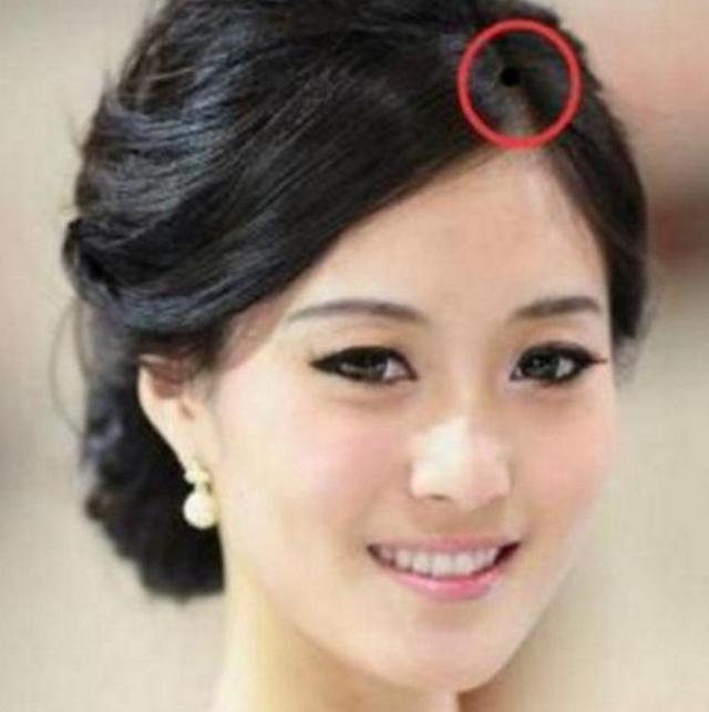 发中藏有痣的女人大多数都是出生家境良好,从小好命