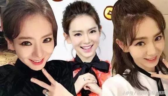 苹果肌和高颧骨之间有超大区别,你分得清楚吗