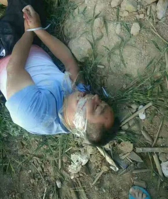 陕西西乡疑现暴力强拆一家人被打伤 官方:操外地口音男子所为