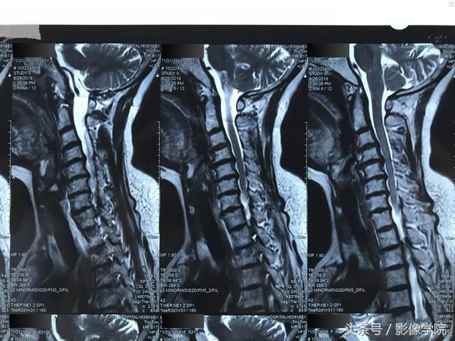 医患通用:如何翻拍X线片,CT片子的网络求医、