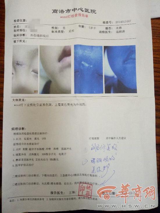 男童幼儿园一月摔两次缝12针 园长:两次皆意外