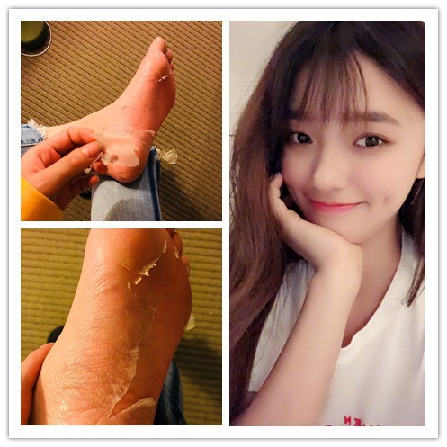 林允撕脚皮炸出一大波"爱好者"原来喜欢看这个的都是强迫症