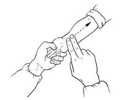 小儿推拿退烧六步图 效果杠杠滴 广大父母必须