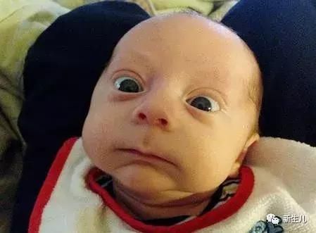 新生儿:宝宝几天不大便怎么办?怎样区别攒肚和