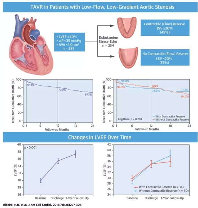 TAVR 治疗低射血分数、低跨瓣压差重度主动脉
