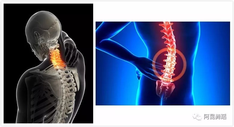 阿昆舞蹈联合山大齐鲁医院骨科专家刘海春