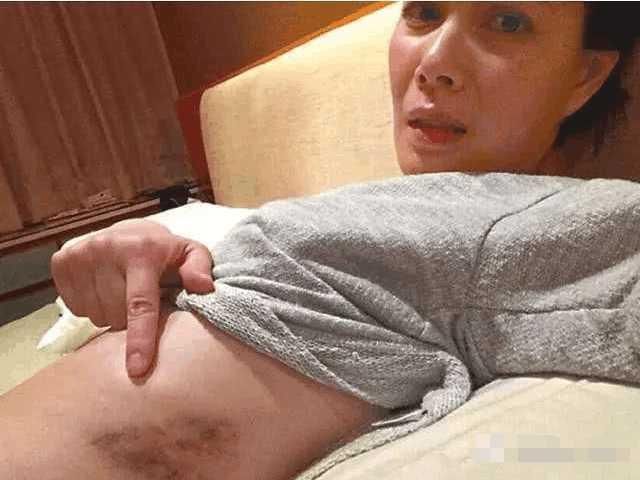 盘点那些年明星们的家暴抵制家暴行为从你我做起