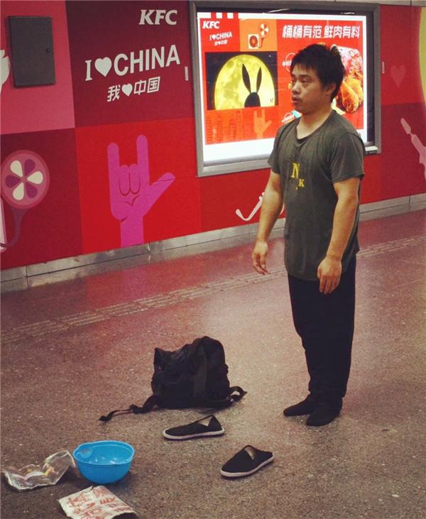 中国体操冠军因伤退役获3万补贴 穷困潦倒变卖