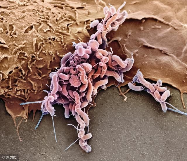 胃不舒服,蜂蜜这样吃,断根幽门螺旋杆菌,胃病