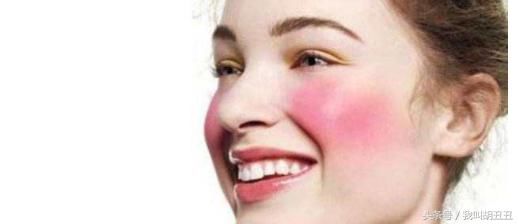 淡化红血丝的日常方法-简单方便