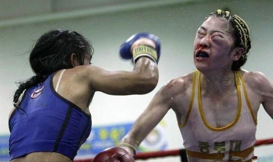 金珠熙直面对手的重拳，面部青肿。