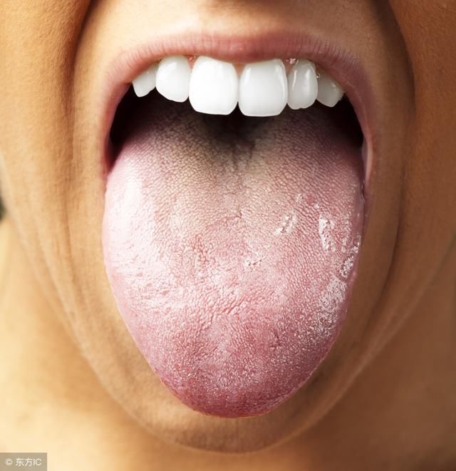 舌头发白是什么原因,听完医生的话你就明白了