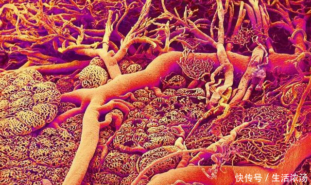 35岁后要多吃1种蔬菜,可以疏通甘油三酯,降血