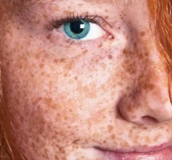 外国美女都往脸上纹雀斑?中国网友们你们怎么看?