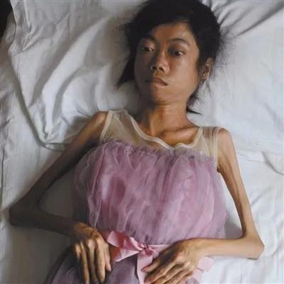 罕见病患者因病返贫 可他们的痛何止