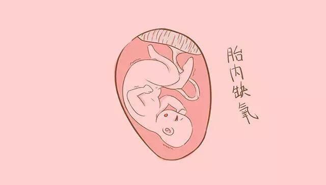 胎儿宫内缺氧,后果很严重,快来给胎宝爱的供氧