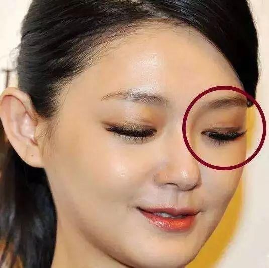 戚薇割双眼皮失败?内双瞬间变欧式你应该跟